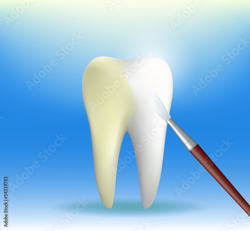 tooth whitening