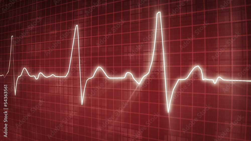 EKG electrocardiogram pulse trace