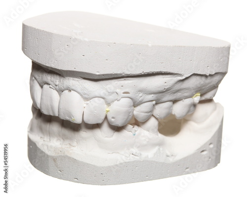фотографія Dental gypsum model mould of teeth in plaster