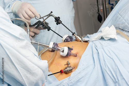 Gastric bypass surgery