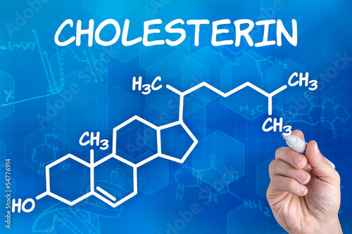 Hand zeichnet chemische Strukturformel von Cholesterin