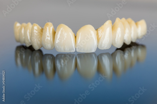 Porcelain teeth - dental bridge