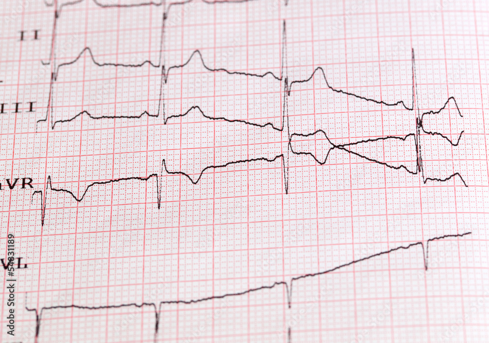 Naklejka premium cardiogram