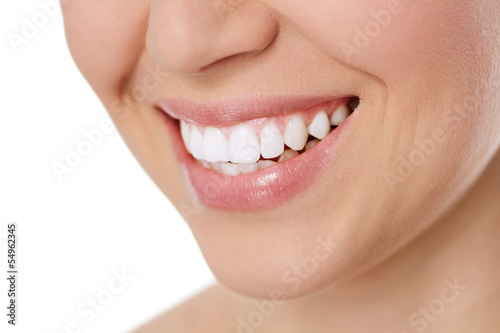 Perfect smile of young woman after teeth whitening, isolated