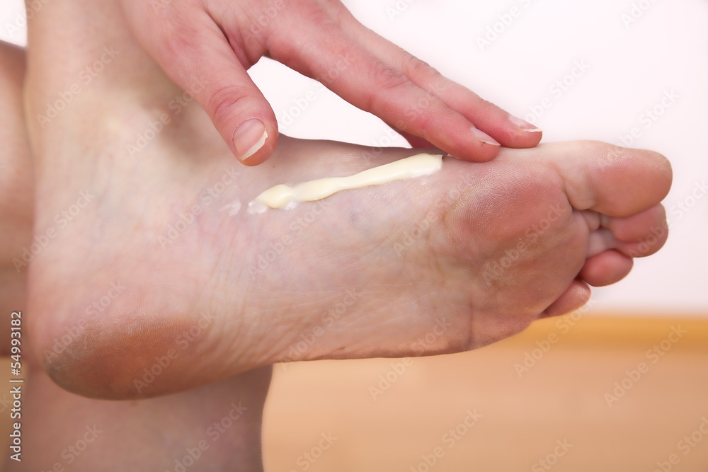 A woman putting cream on her foot A woman putting cream on her foot