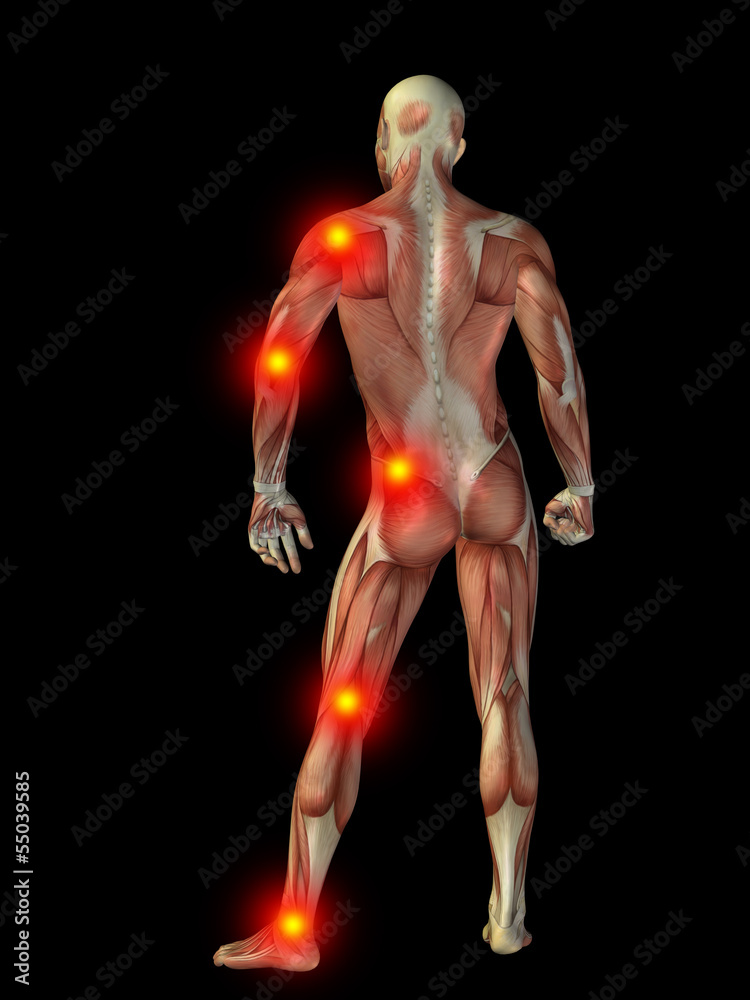 3D human man anatomy with articular pain 3D human man anatomy with articular pain