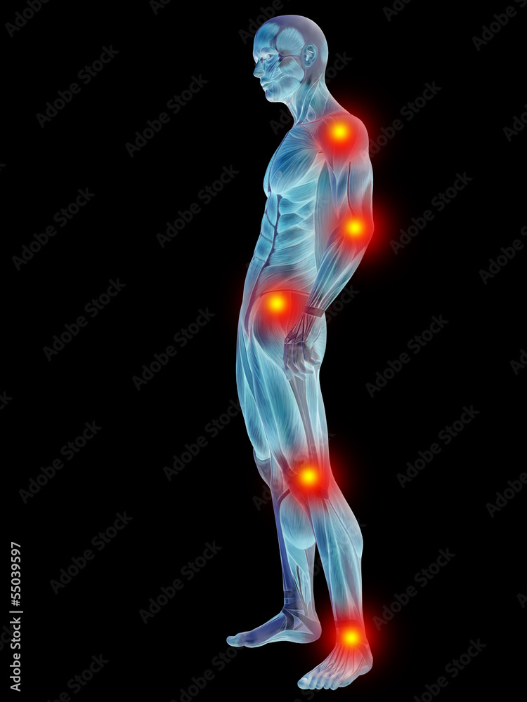 3D human man anatomy with articular pain 3D human man anatomy with articular pain