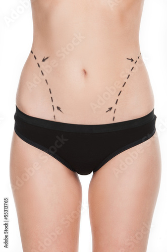 Body improving. Cropped image of female body with marks on abdom