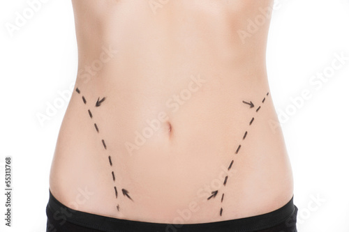 Body improving. Close-up of female body with marks on abdomen