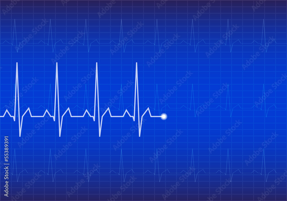 ECG Electrocardiogram, vector