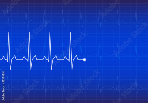 ECG Electrocardiogram, vector
