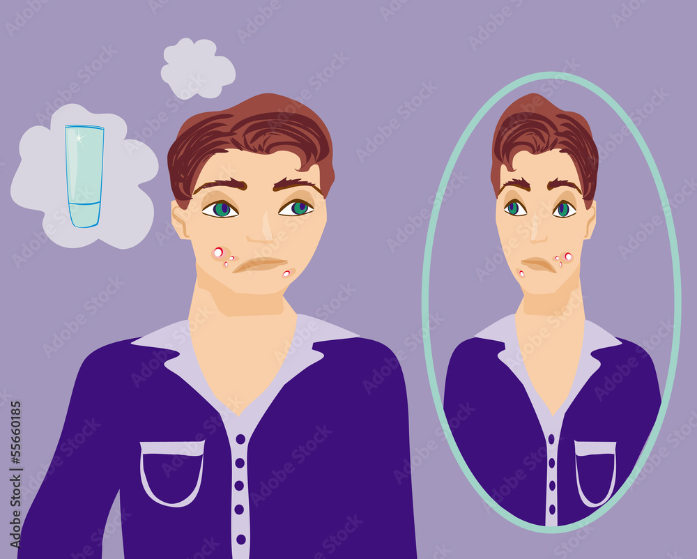 boy in puberty with acne boy in puberty with acne