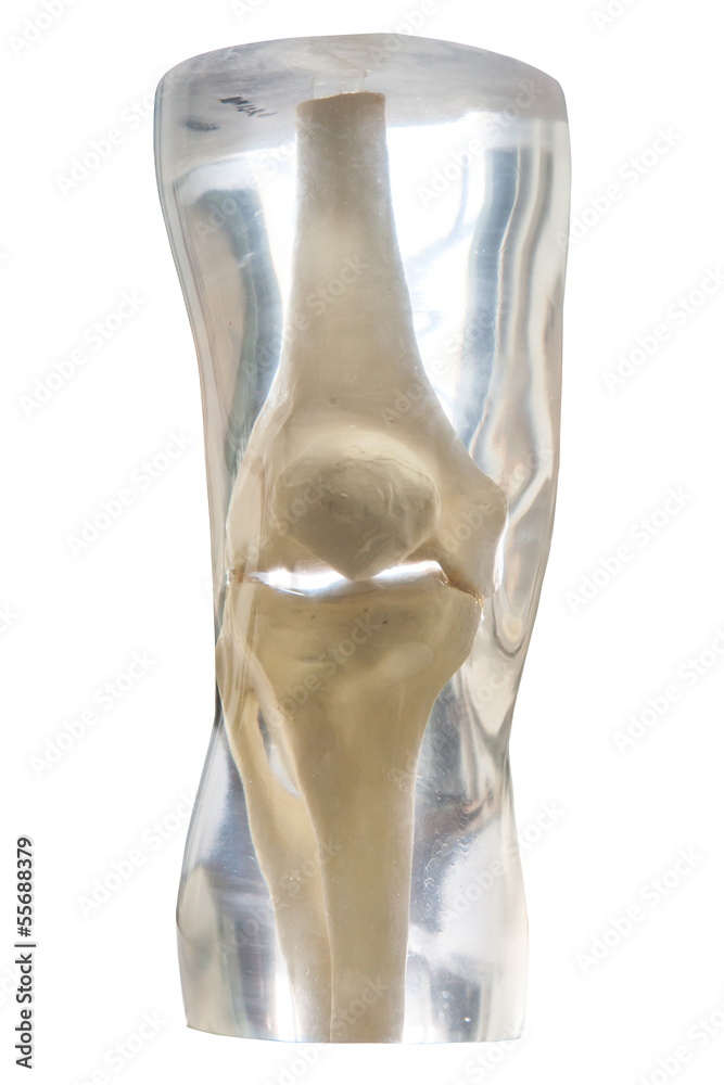 X-Ray Phantom knee