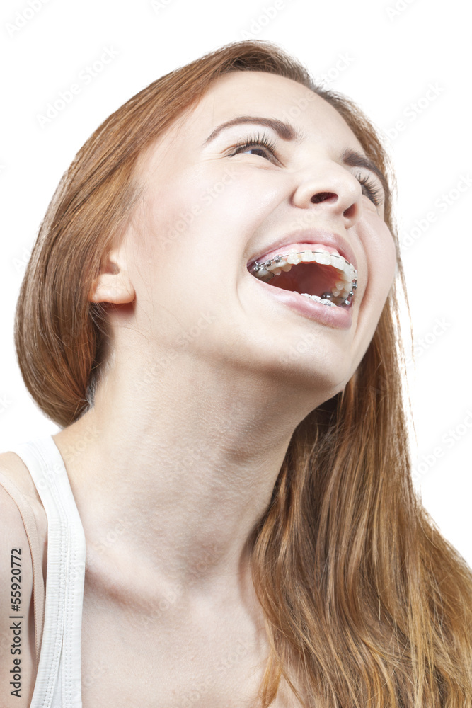 Girl with braces Girl with braces