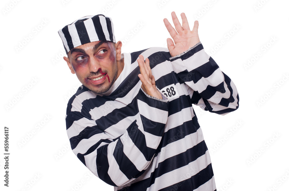 Prisoner with bad bruises on white Prisoner with bad bruises on white