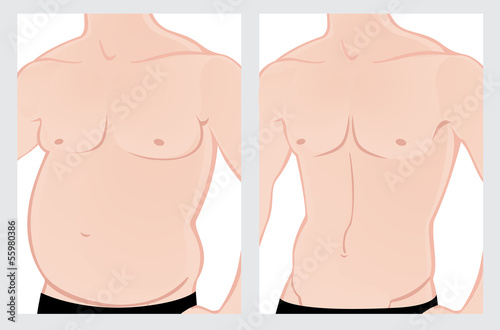 Male abdomen before and after treatment