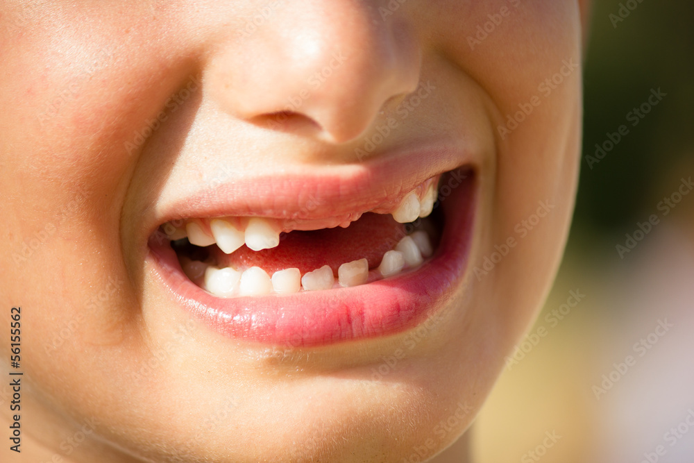 bambino che sorride senza denti Stock Photo | Adobe Stock