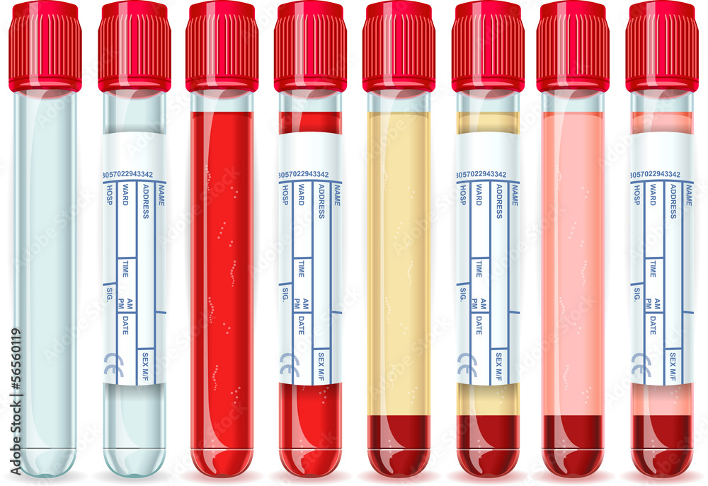 Red Cap Tube with Six Possible Uses Red Cap Tube with Six Possible Uses