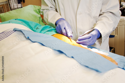 Doctor preparing to suture