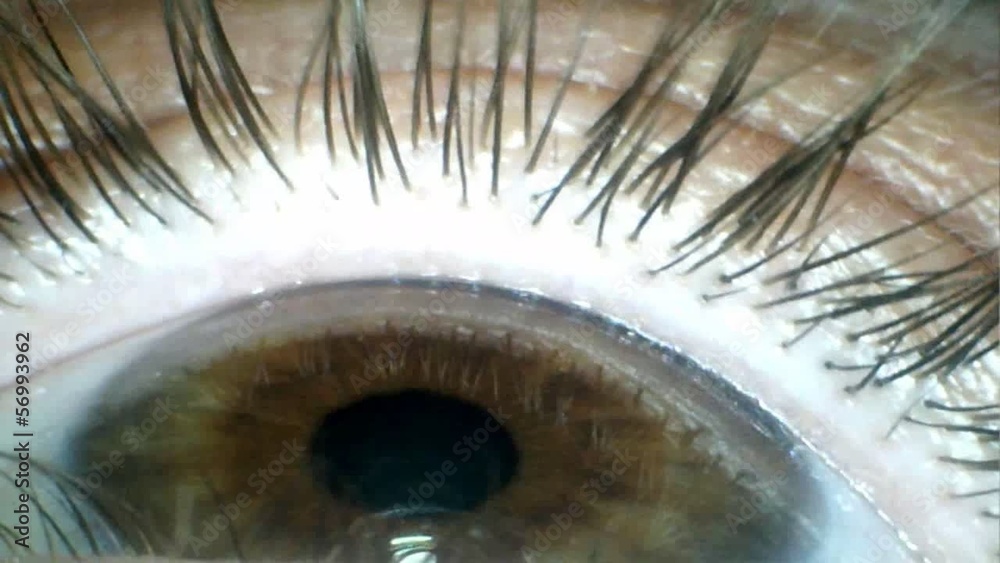 Ojo visto con lupa