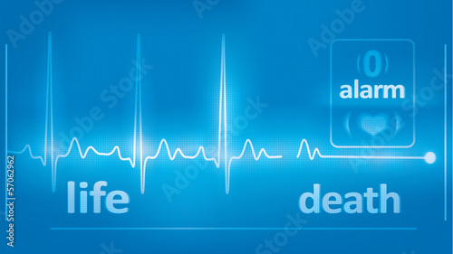 heart beats cardiogram, and asystole on monitor. detailed vector