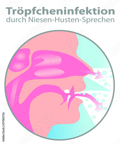 Tröpfcheninfektion durch Niesen & Husten