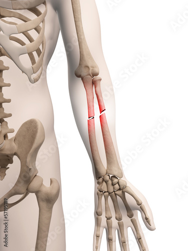 medical illustration of arm bone photo