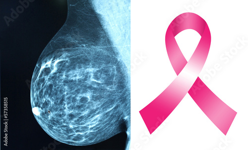 Pink ribbon for breast cancer awareness with mammogram image