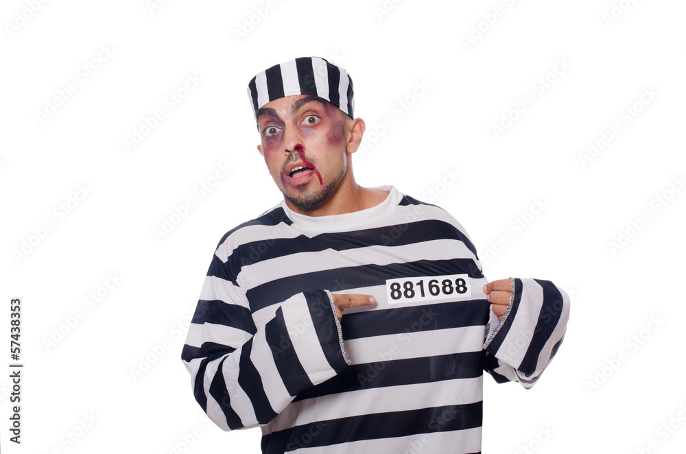 Prisoner with bad bruises on white Prisoner with bad bruises on white