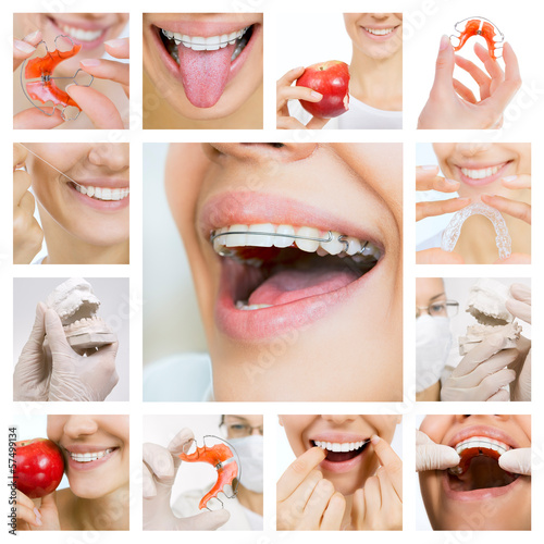 dental care collage (dental services) #57499134