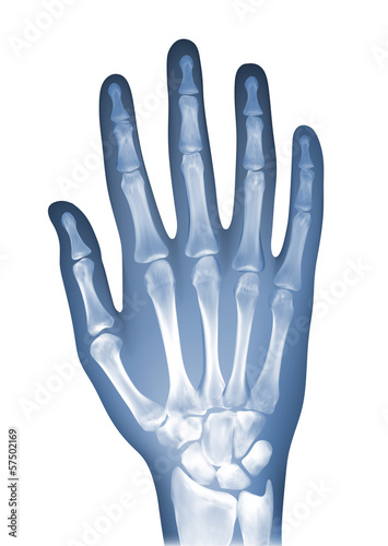 Hand xray