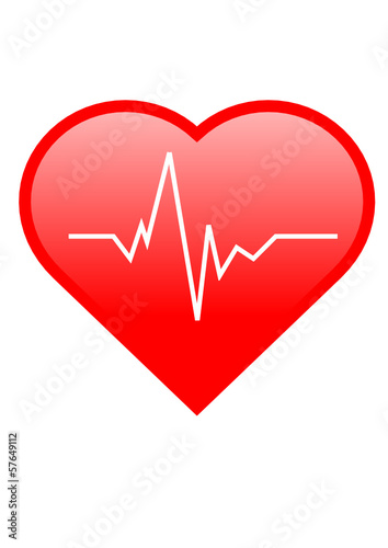 Herz EKG