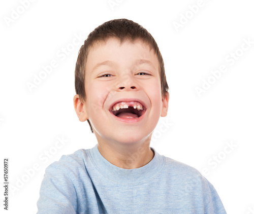 Boy portrait with a lost tooth