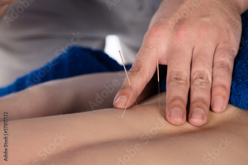 Physiotherapist doing accupuncture © nanettegrebe
