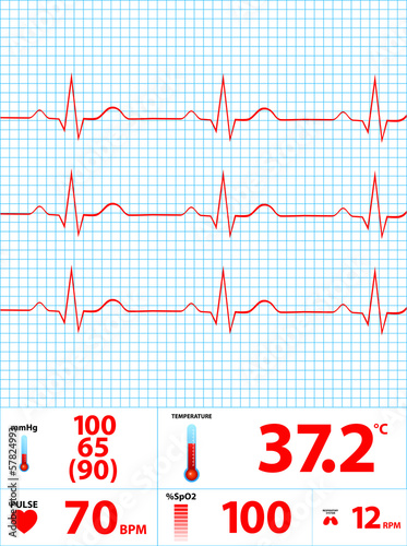 Modern Electrocardiogram Monitor Display