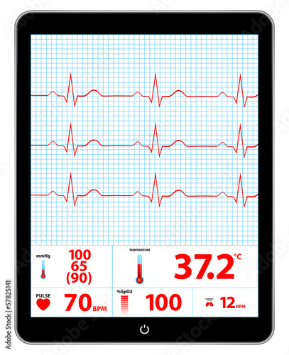 Modern Electrocardiogram Monitor Device Display