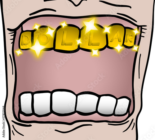 Gold teeth