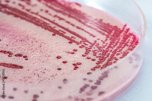 Listeria