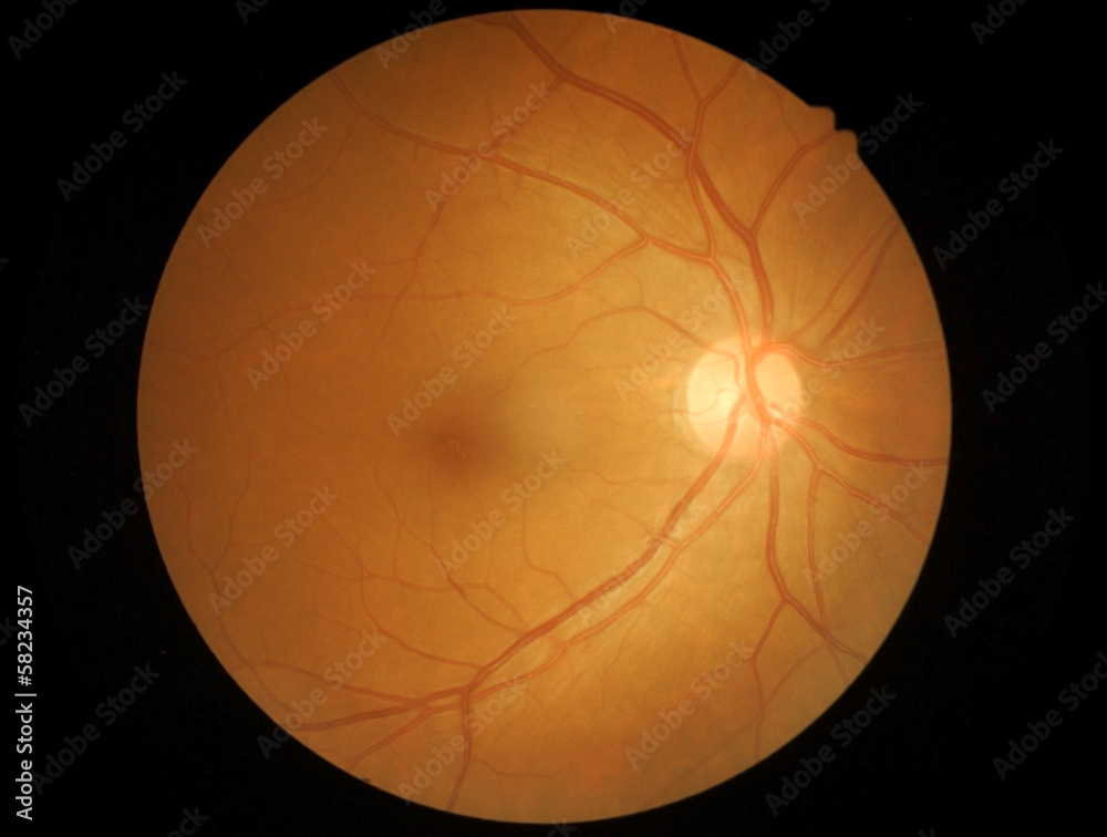 Medical photo retina and optic nerve - obrazy, fototapety, plakaty 