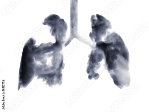 Smoke shaped as human lungs.