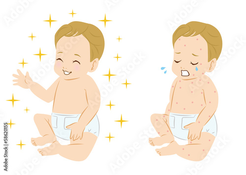 赤ちゃん　発疹