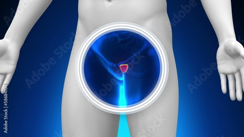 Medical X-Ray Scan - Prostate photo