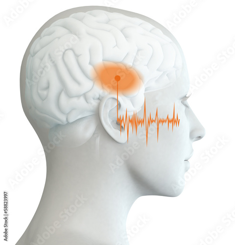 Menschliches Ohr einer Frau mit Schallwellen