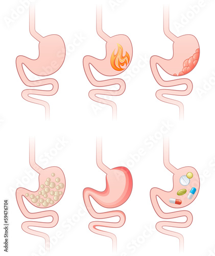 Stomach sick