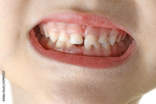 macro child teeth