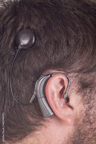 close up young man with cochlear implant photo