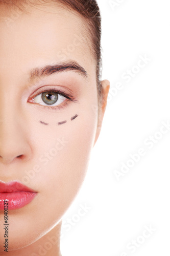 Woman marked out for cosmetic surgery.
