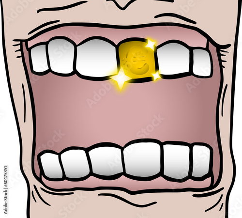 Gold tooth