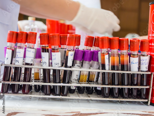 blood tubes in the laboratory