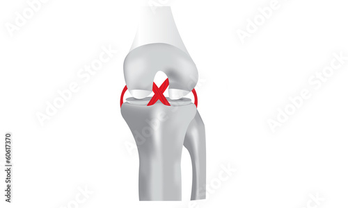 The Knee Joint